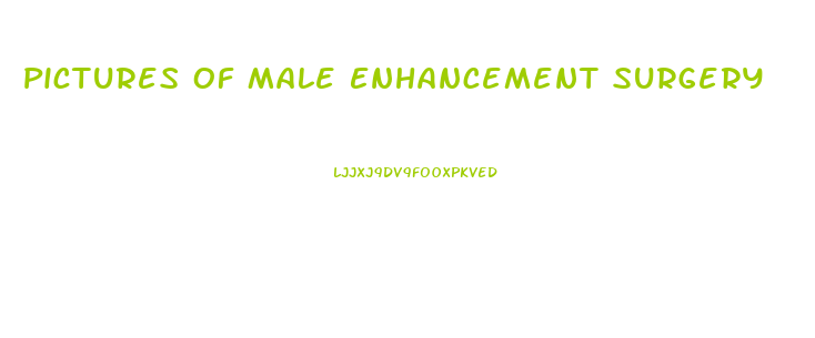 Pictures Of Male Enhancement Surgery