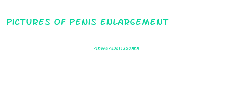 Pictures Of Penis Enlargement