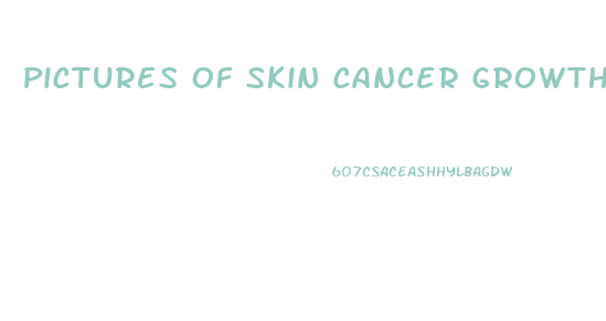 Pictures Of Skin Cancer Growths On Peni