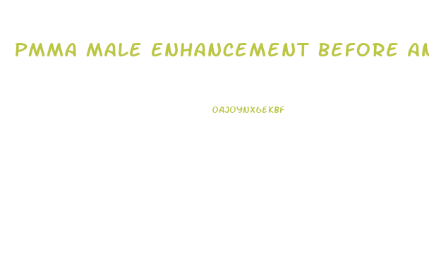 Pmma Male Enhancement Before And After