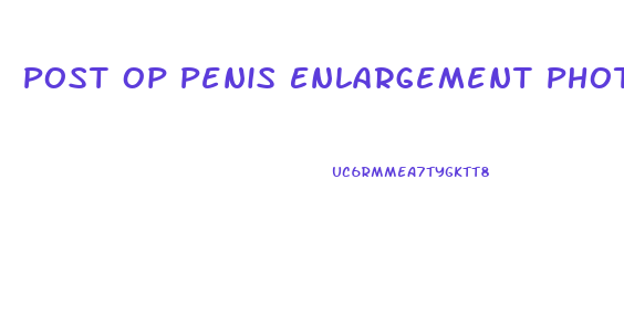 Post Op Penis Enlargement Photos