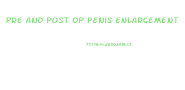 Pre And Post Op Penis Enlargement