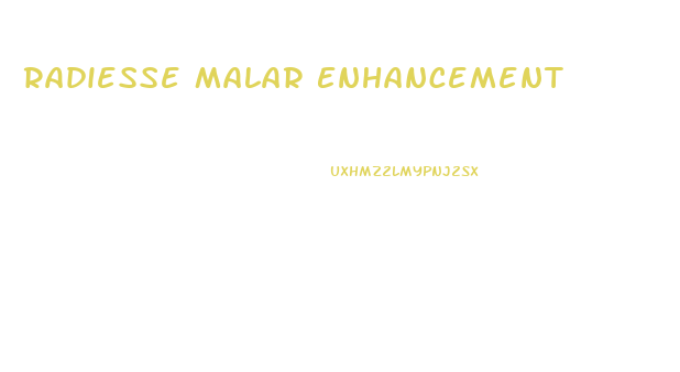 Radiesse Malar Enhancement