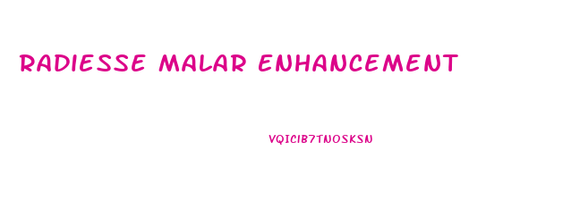 Radiesse Malar Enhancement