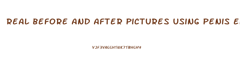 Real Before And After Pictures Using Penis Enlargement Remedy