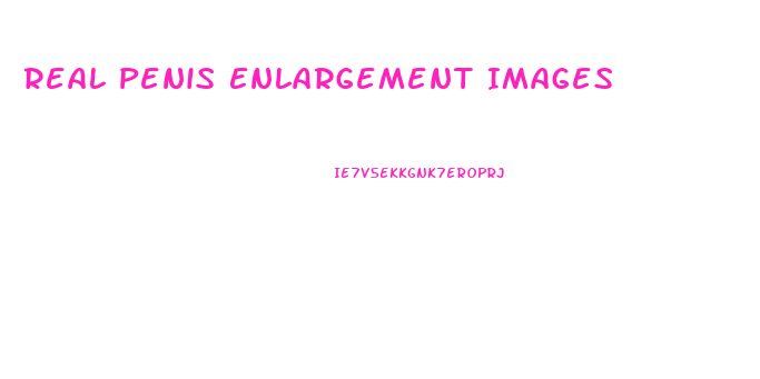 Real Penis Enlargement Images