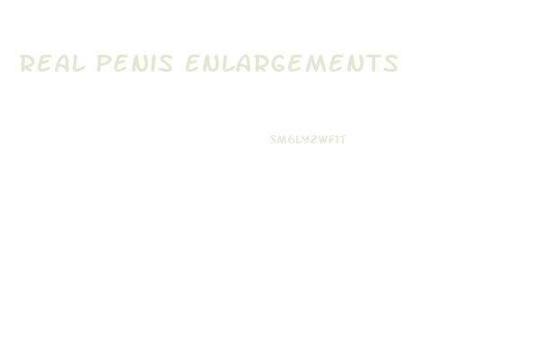 Real Penis Enlargements