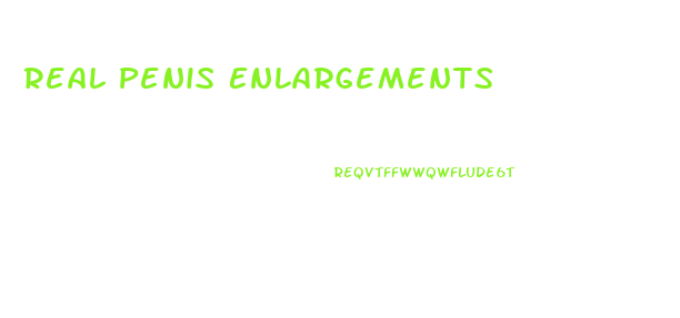 Real Penis Enlargements