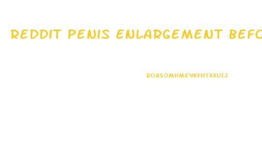 Reddit Penis Enlargement Before And After