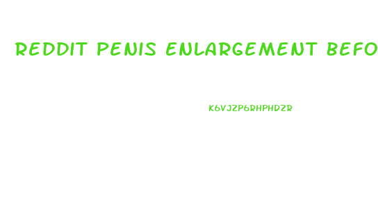 Reddit Penis Enlargement Before And After