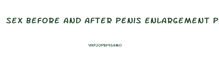 Sex Before And After Penis Enlargement Porn