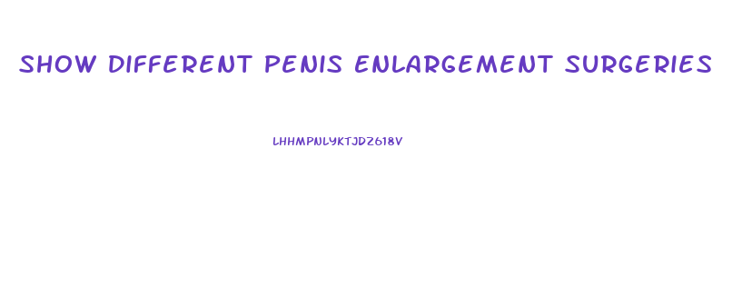 Show Different Penis Enlargement Surgeries