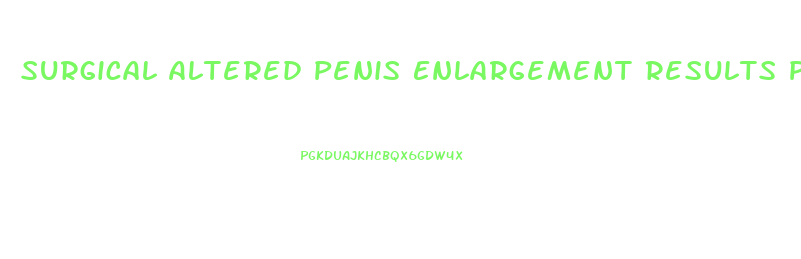 Surgical Altered Penis Enlargement Results Photos