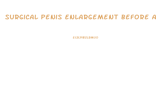 Surgical Penis Enlargement Before After