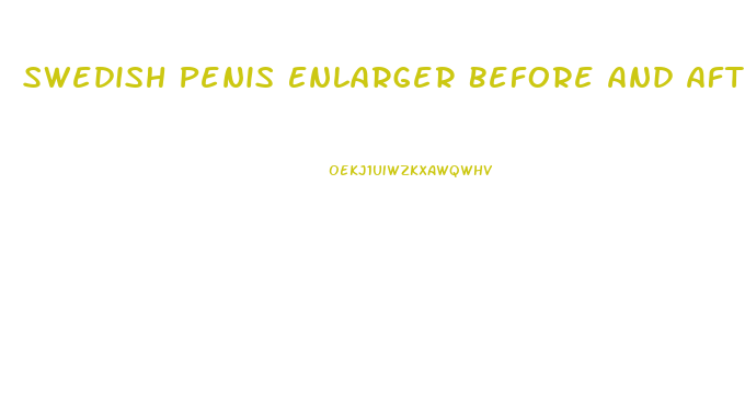 Swedish Penis Enlarger Before And After