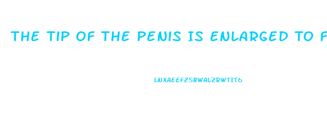 The Tip Of The Penis Is Enlarged To Form The 