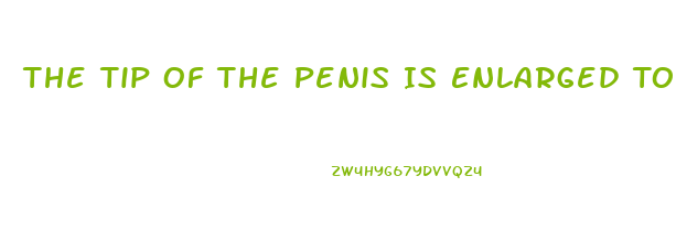 The Tip Of The Penis Is Enlarged To Form The