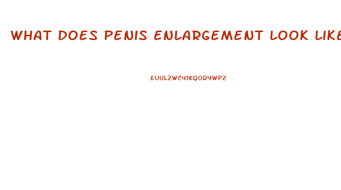 What Does Penis Enlargement Look Like