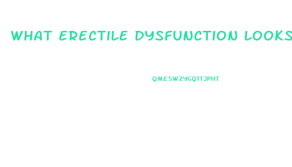 What Erectile Dysfunction Looks Like