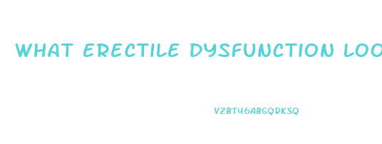 What Erectile Dysfunction Looks Like