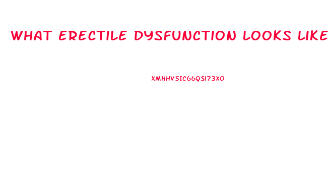 What Erectile Dysfunction Looks Like
