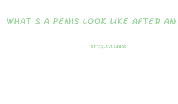 What S A Penis Look Like After An Enlargement Surgery