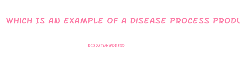 Which Is An Example Of A Disease Process Producing Diffuse Cortical Dysfunction