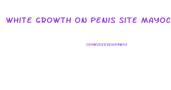 White Growth On Penis Site Mayoclinic Org