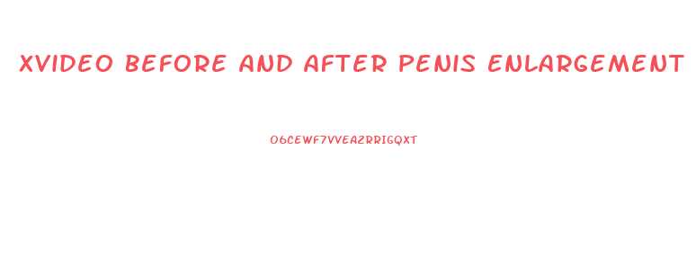 Xvideo Before And After Penis Enlargement