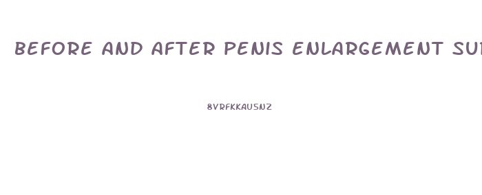 before and after penis enlargement surgery surgery life enhancement