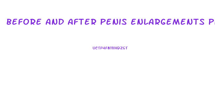 before and after penis enlargements photos