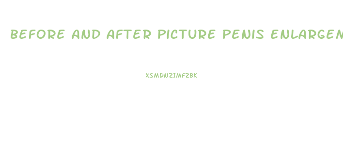 before and after picture penis enlargement