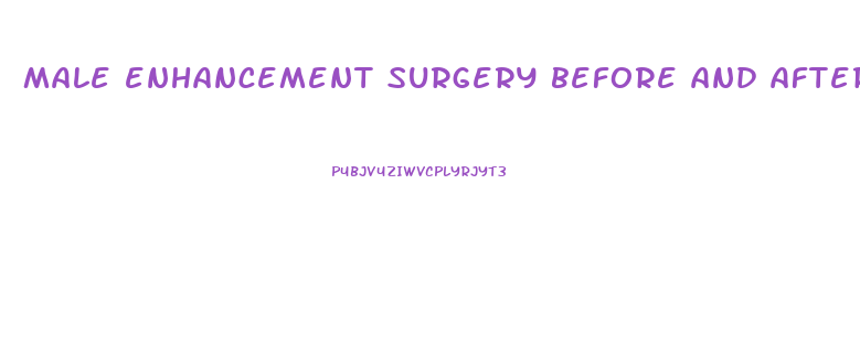 male enhancement surgery before and after pictures