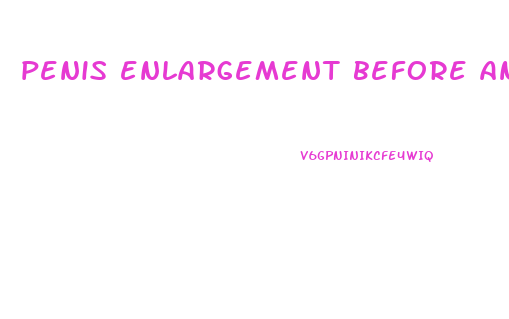 penis enlargement before and after photos