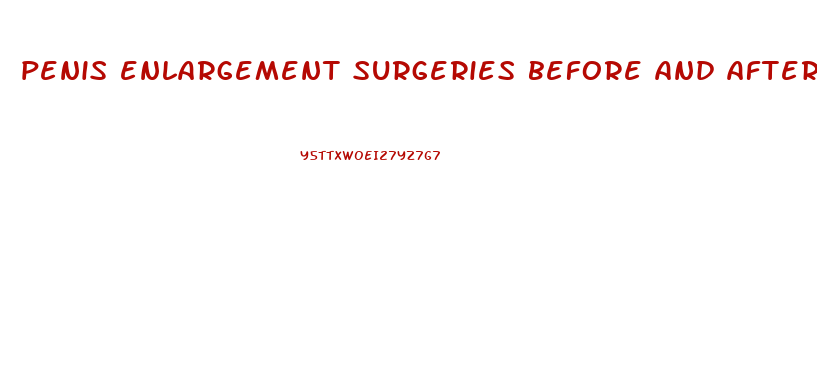 penis enlargement surgeries before and after