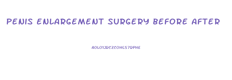 penis enlargement surgery before after