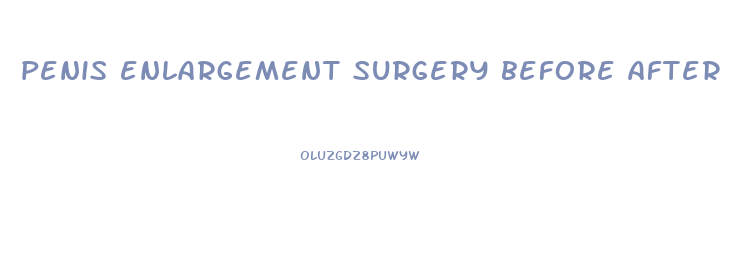 penis enlargement surgery before after erect
