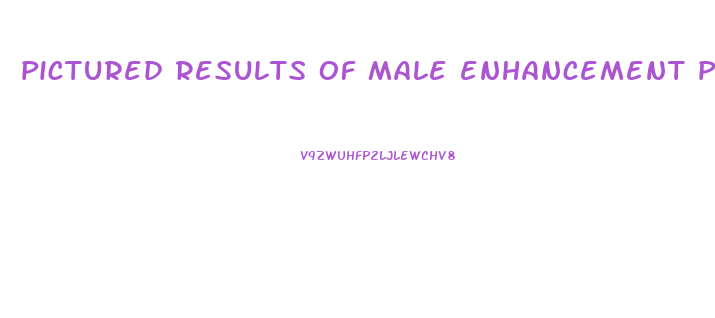 pictured results of male enhancement pills