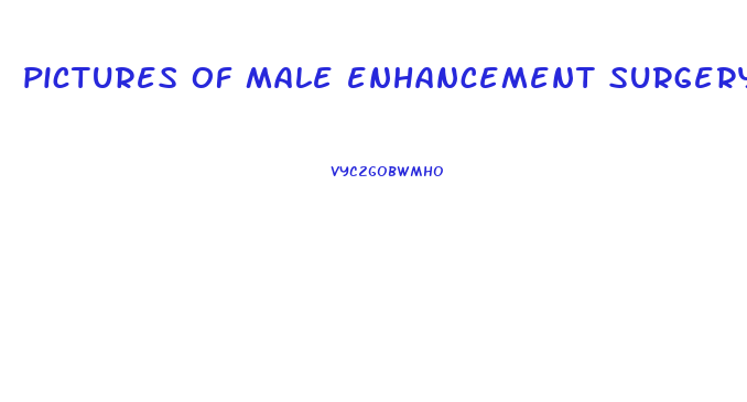 pictures of male enhancement surgery