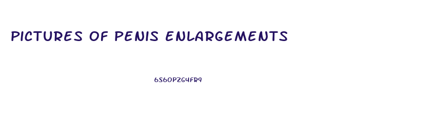 pictures of penis enlargements