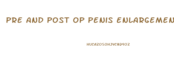 pre and post op penis enlargement