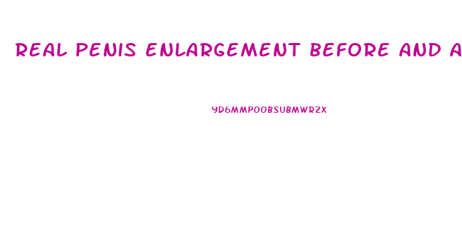 real penis enlargement before and after