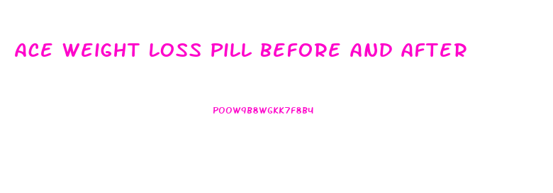 Ace Weight Loss Pill Before And After