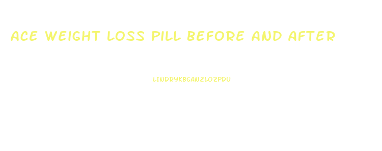 Ace Weight Loss Pill Before And After