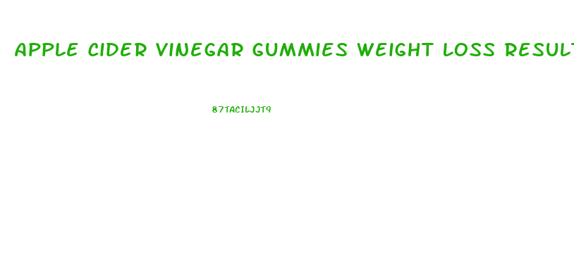 Apple Cider Vinegar Gummies Weight Loss Results