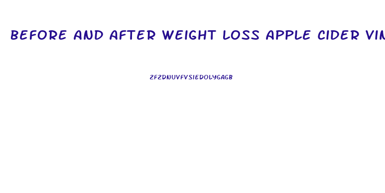 Before And After Weight Loss Apple Cider Vinegar Pills