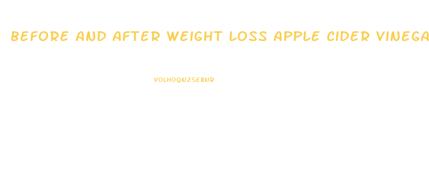 Before And After Weight Loss Apple Cider Vinegar Pills