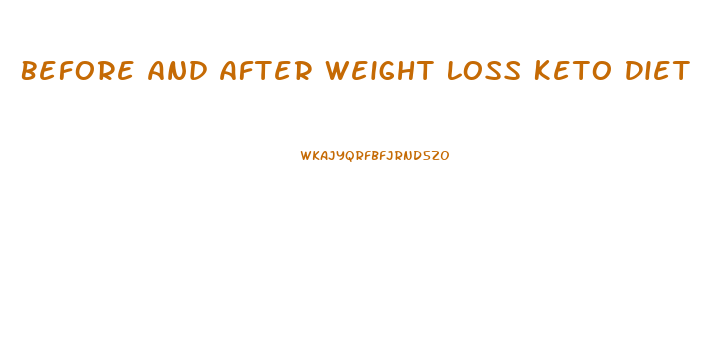 Before And After Weight Loss Keto Diet