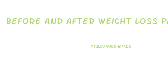 Before And After Weight Loss Paelo Diet