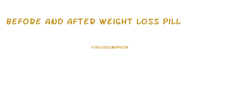 Before And After Weight Loss Pill